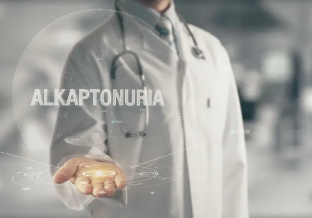 Alkaptonuria - jak rozpoznać chorobę czarnego moczu?