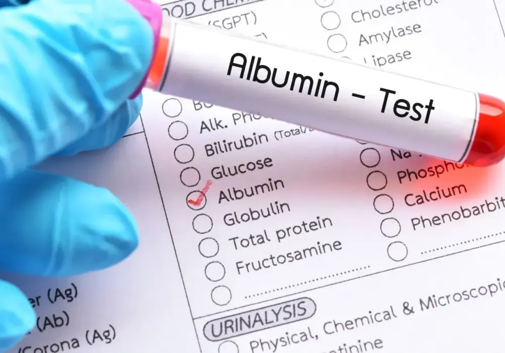 Albuminy - co to jest i dlaczego są tak ważne dla zdrowia?