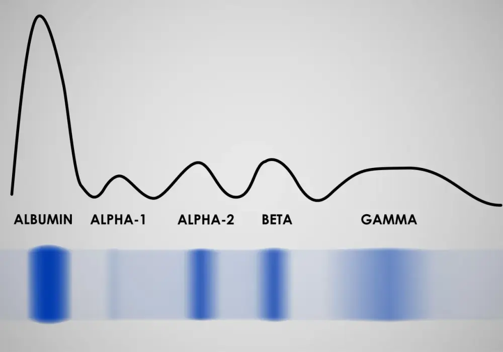 Globuliny - Co to jest i jak czytać proteinogram?