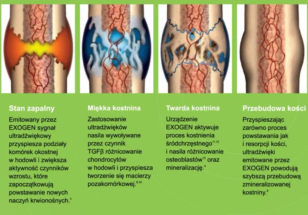 Okostna - dlaczego jest kluczowa dla wzrostu i gojenia kości?