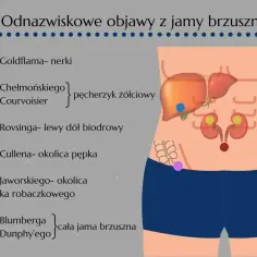 Ilustracja pokazuje lokalizację objawów otrzewnowych w jamie brzusznej, takich jak objaw Blumberga.