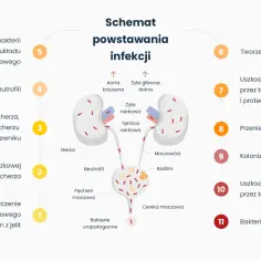 Schemat powstawania infekcji dróg moczowych: od namnażania bakterii, przez kolonizację pęcherza i nerek, po bakteriemię.