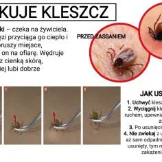 Ilustracja pokazuje kleszcza przed, w trakcie i po zassaniu, a także instrukcję usuwania. Ten kleszcz to prawdziwy kicz, który atakuje bez ostrzeżenia.