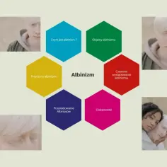 Portret osoby z albinizmem, obok schemat informacyjny o albinizmie.