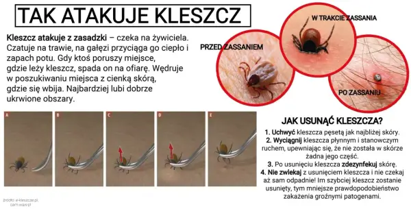 Kicz - Jak go rozpoznać i dlaczego nas przyciąga?