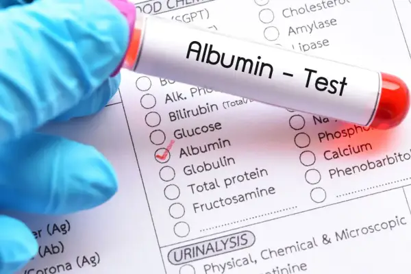 Albuminy - co to jest i dlaczego są tak ważne dla zdrowia?