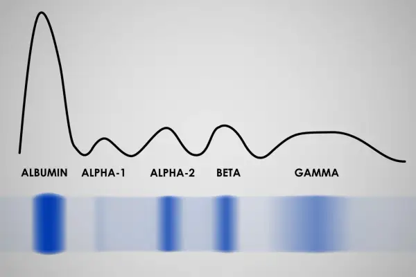 Globuliny - Co to jest i jak czytać proteinogram?