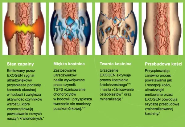 Okostna - dlaczego jest kluczowa dla wzrostu i gojenia kości?